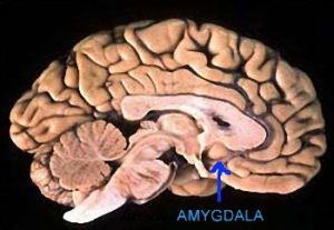 amygdala1-300x207